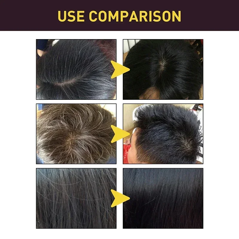 黒染毛シャンプー,天然ハーブ,インスタントカラー,光沢のある - Hair Care Loreal のレビューと価格