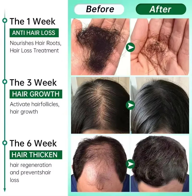 育毛血清 7 日間高速再生エッセンシャルカプセル抗脱毛ハゲ修 - Hair Care Capsule のレビューと価格