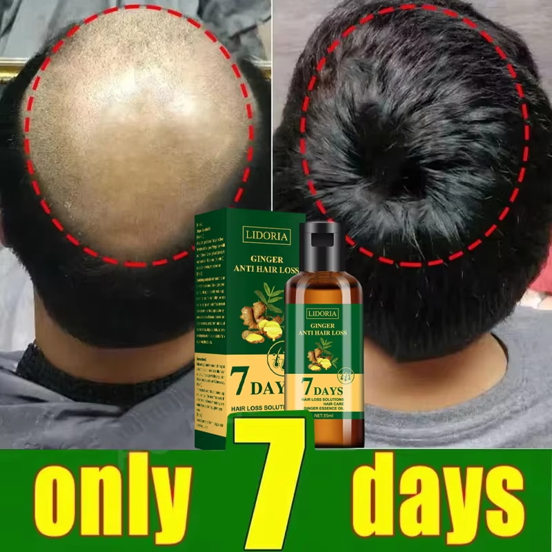 育毛血清 7 日間高速再生エッセンシャルカプセル抗脱毛ハゲ修 - Hair Care Capsule のレビューと価格
